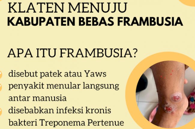 Klaten Menuju Kabupaten Bebas Frambusia tahun 2022